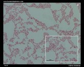 vibrio cholerae Gram-stain